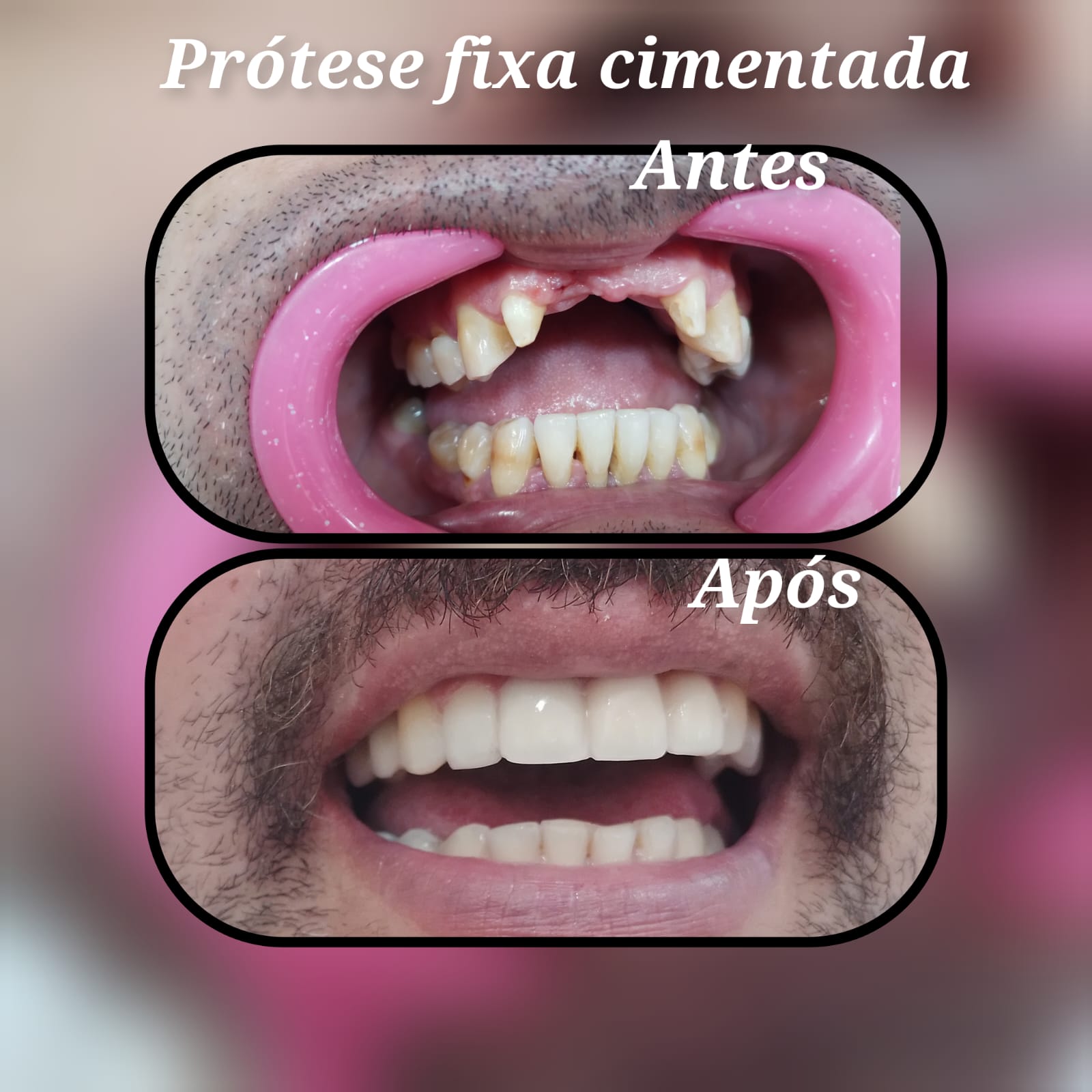 Resultado 1